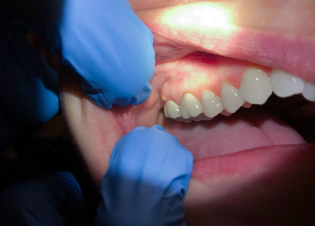 Best Broken or Chipped Tooth Repair in Crouch Mesa, NM
