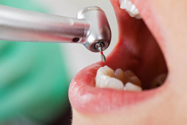 Best Walk-In Emergency Dental Services in Crouch Mesa, NM
